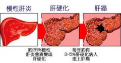 早期少精的须做的检查