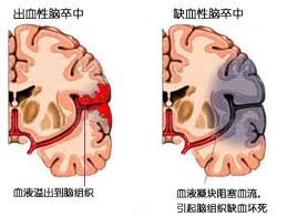 非淋病常见的哪些具体表现