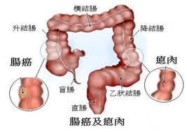 早泄患者要提前了解其检查方法