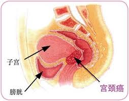 常见的射精障碍的发病原因