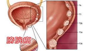 阴虱概述